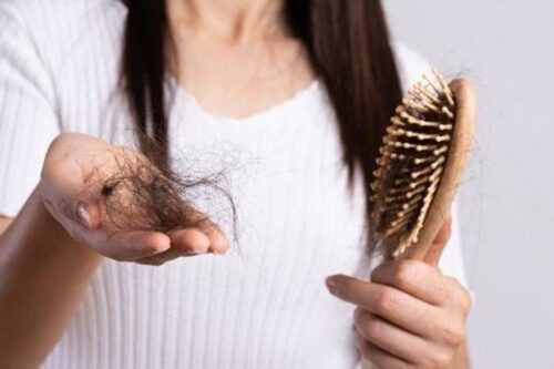 Summarize 5 causes of hair loss and their remedies 16