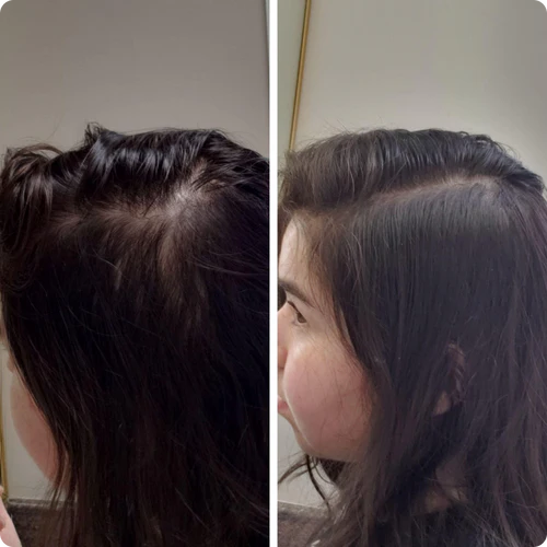 <img src="https://alikanature.com/wp-content/uploads/2025/04/hair-bond-spray-author-2.webp"><br>Melanie T.